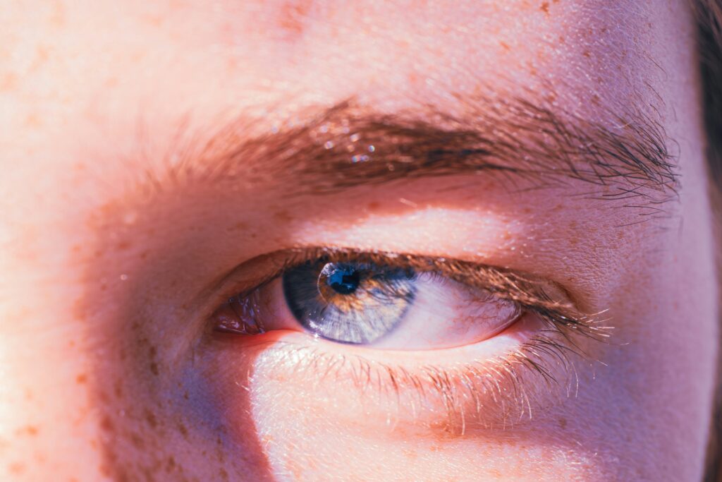 orthokeratology