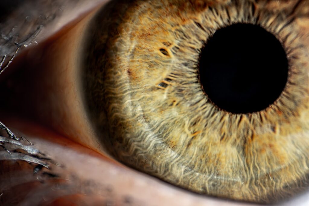 age related maculopathy macula retina central vision