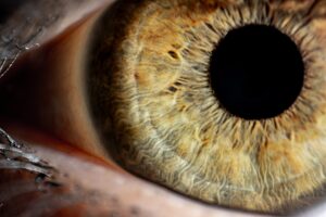 age related maculopathy macula retina central vision