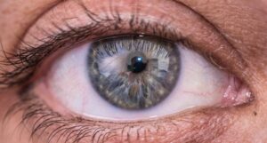 early glaucoma symptoms