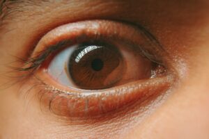 what causes amblyopia