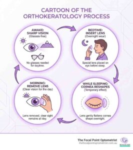 Ortho-k: How It Works And What’s Involved