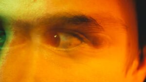 concussions and their effect on vision